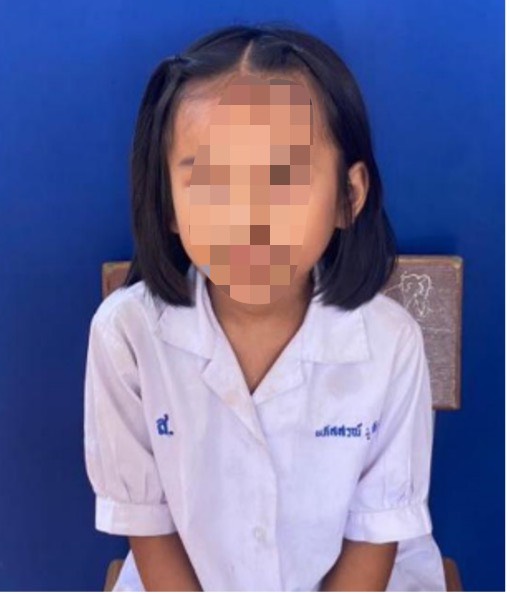 “หนูยังโชคดี” จังหวัดอุดรธานี